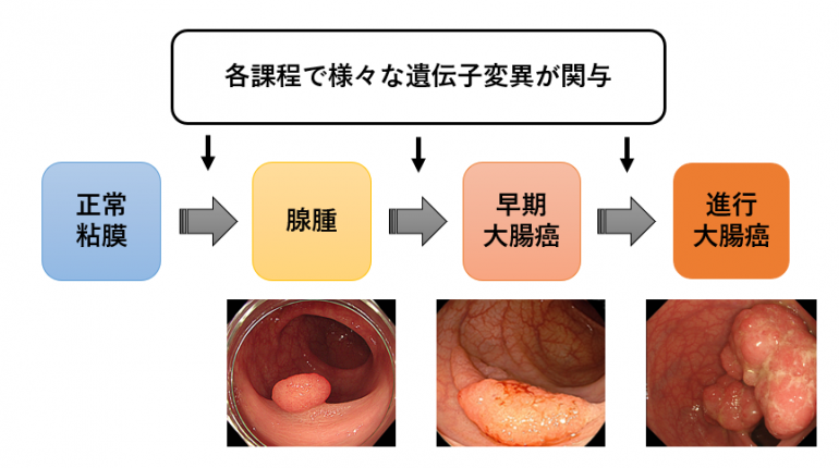 大腸 ポリープ を 小さく する 方法