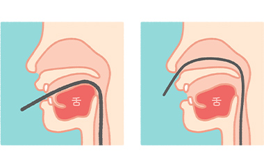 経口・経鼻内視鏡で苦痛を軽減
