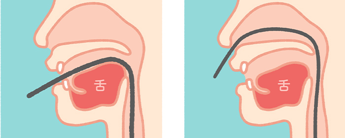 経口・経鼻内視鏡で苦痛を軽減