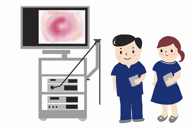 大腸カメラ検査がおすすめ